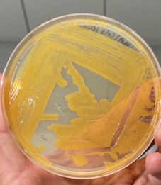 Análisis metagenómica, asignación taxonómica