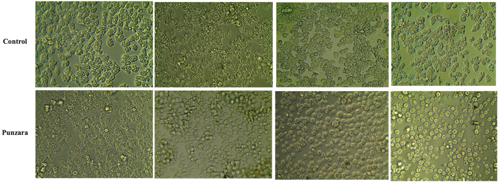 virus gigantes nucleocitoplasmáticos de ADN (NCDLVs) 
