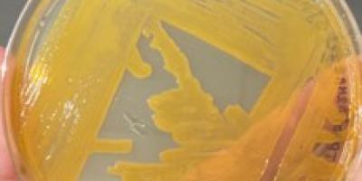 Análisis metagenómica, asignación taxonómica