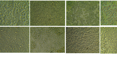 virus gigantes nucleocitoplasmáticos de ADN (NCDLVs) 